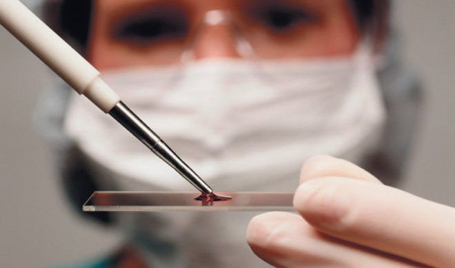 Анализ крови на содержание гормонов щитовидной железы