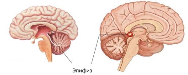 эпифиз