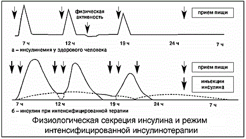 Интенсифицированная инсулинотерапия