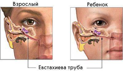 Слуховая трубка